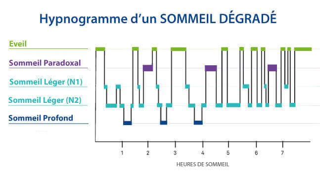 cycle du sommeil